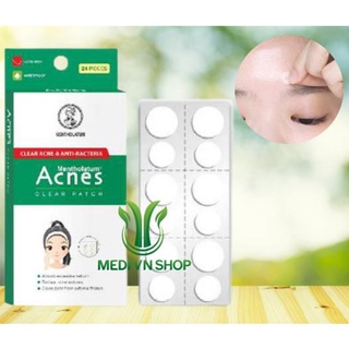 Miếng Dán Mụn - Giúp Giảm Mụn Sưng Viêm (Hộp 24 Miếng)
