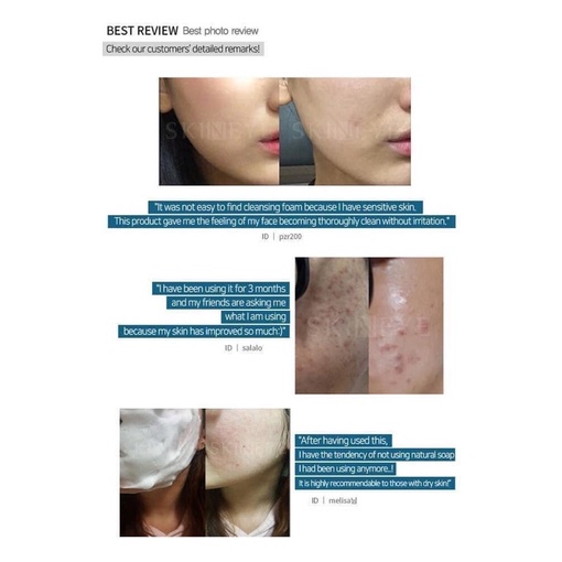 Sữa rửa mặt trị mụn Skin Eye Acne Pure Cleansing Foam