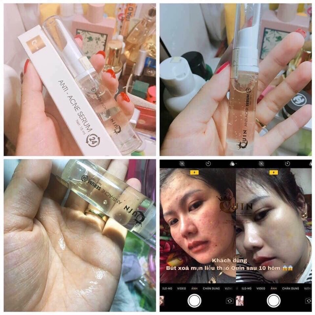 [ BÚT THẦN XOÁ MỤN Thương hiệu CAO CẤP QUIN] | BigBuy360 - bigbuy360.vn