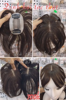Đỉnh đầu hói tóc thật