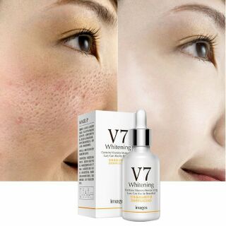 Serum V7 Whitening