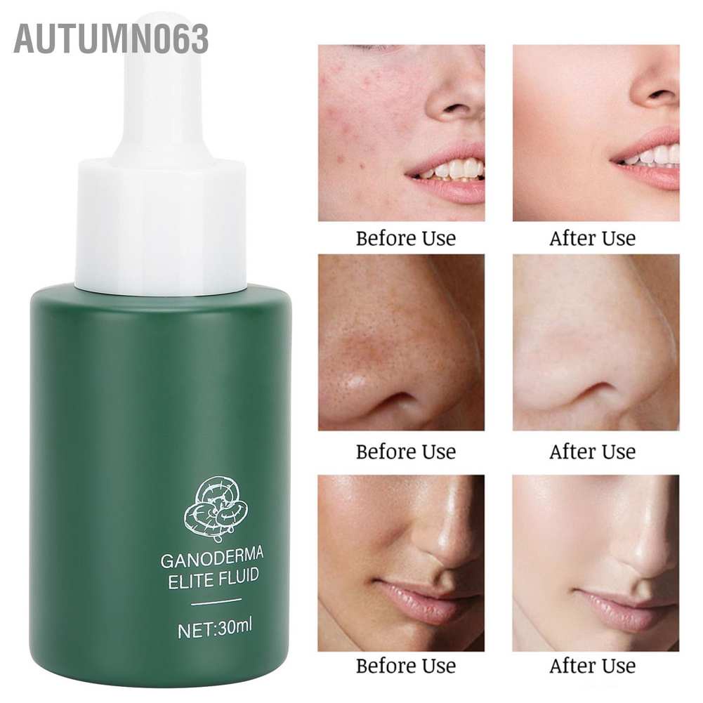 ⚡Hàng giao ngay⚡Serum phục hồi da linh chi Giải pháp nuôi dưỡng làm săn chắc da mặt 30ml