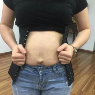 Đai latex
