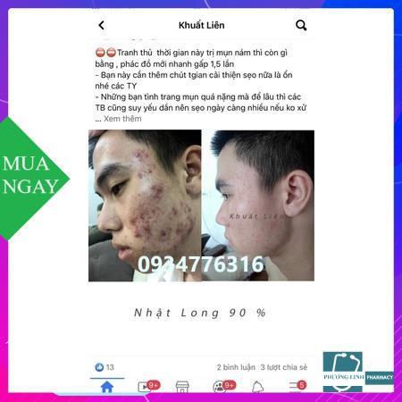 mặt nạ bạch hồng đơn date2024