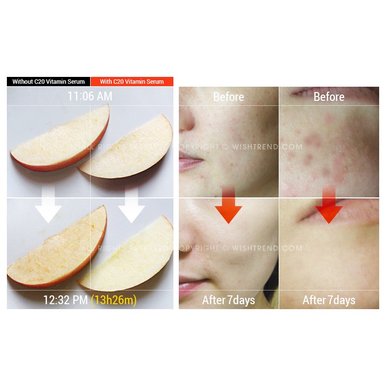 Tinh Chất Vitamin C Dưỡng Trắng Da, Mờ Thâm Nám By Wishtrend Pure Vitamin C 21.5