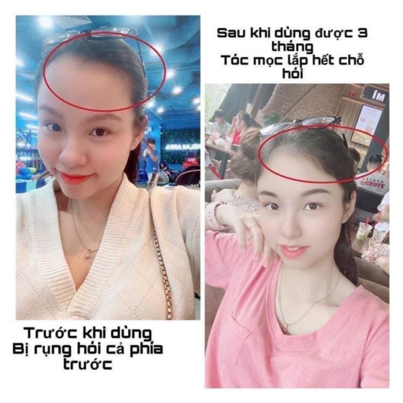 Dầu gội bưởi + Gel ủ bưởi +tinh dầu bưởi Nga Hoàng ,tinh dầu hoàng cầm +Dầu Gội Maccadin + Ủ Xả Bưởi Dừa ARGAN Mẫu Mới 4