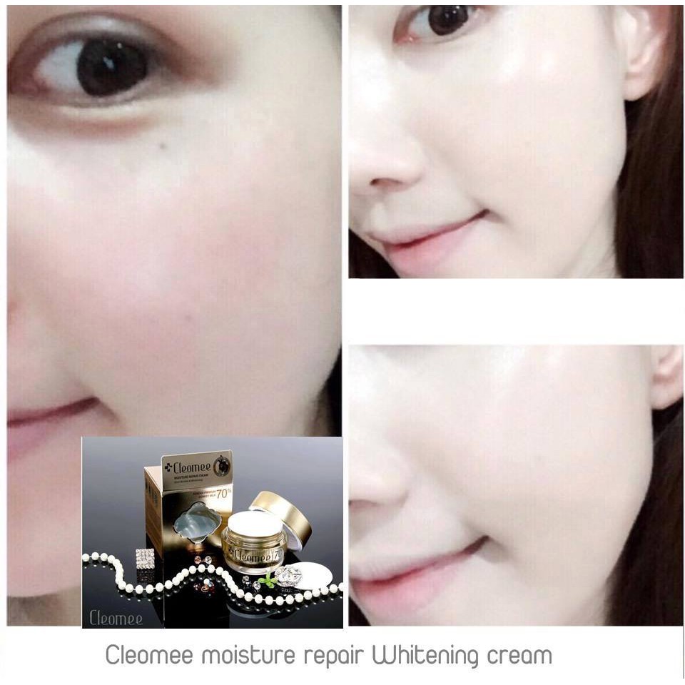 Kem Dưỡng Trắng Tái Tạo Da Chiết Xuất Sữa Lừa Cleomee Moisture Repair Cream