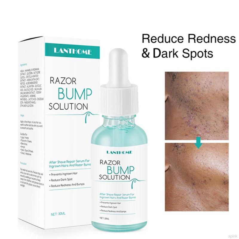 Serum Tinh Chất 30ml Giúp Giảm Đốm Đỏ Và Làm Mượt Da Sau Khi Cạo Lông