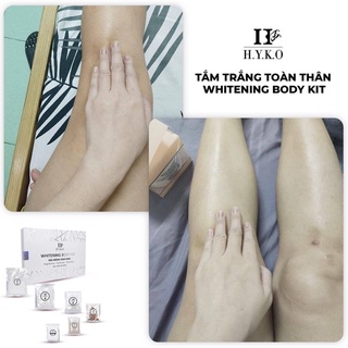 Tắm Trắng HYKO