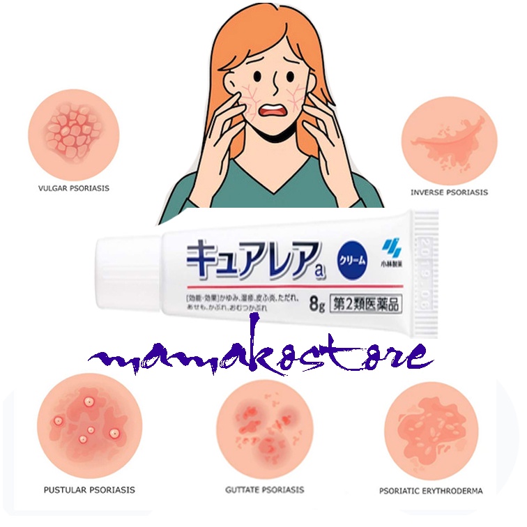 Kem ngứa, dị ứng, phát ban( da mặt) Kobayashi Cure Rare Nhật Bản tuýp 8g Nhật Bản/data 2025