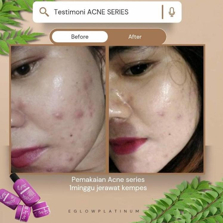 Pkd-557|⭐ Đai Nịt Bụng Và busui Bạch Kim An Toàn Cho Mẹ Bầu⭐Xe tăng | BigBuy360 - bigbuy360.vn