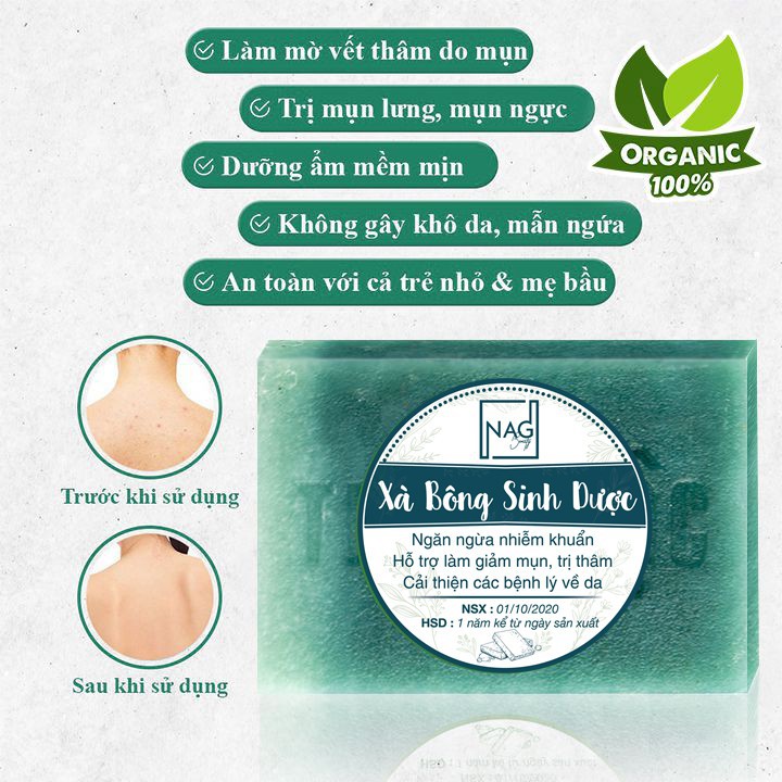 Xà bông tắm giảm mụn lưng NAG Soap 130gr xà phòng thảo dược sạch mụn trên cơ thể - NAG