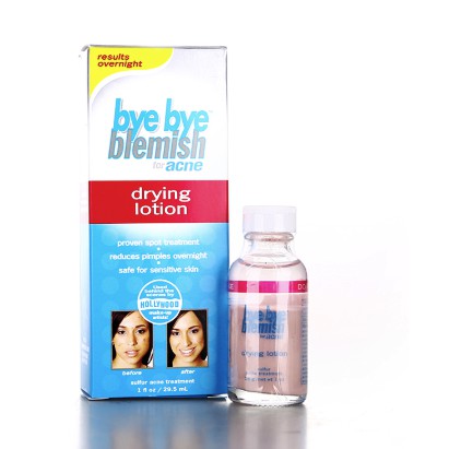 Chấm mụn Bye bye blemish (tự order)