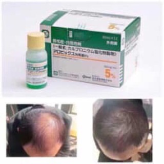Thuốc mọc tóc sato