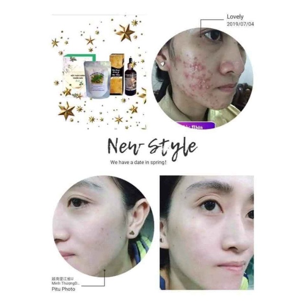 Đông Y Mộc Nhân Tái Tạo Da Thiên Nhiên Lọ 100ml