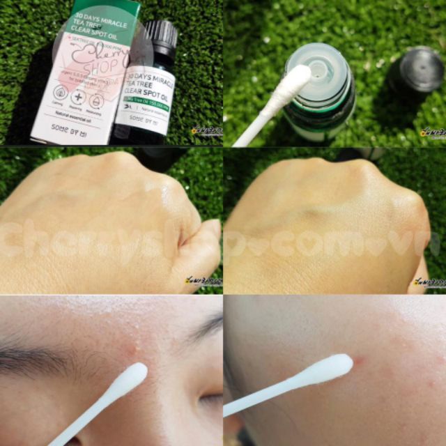 💥🍒Tinh Dầu Tràm Trà "Thần Kỳ" Some By Mi 30 Days Miracle Tea tree Clear spot oil | BigBuy360 - bigbuy360.vn