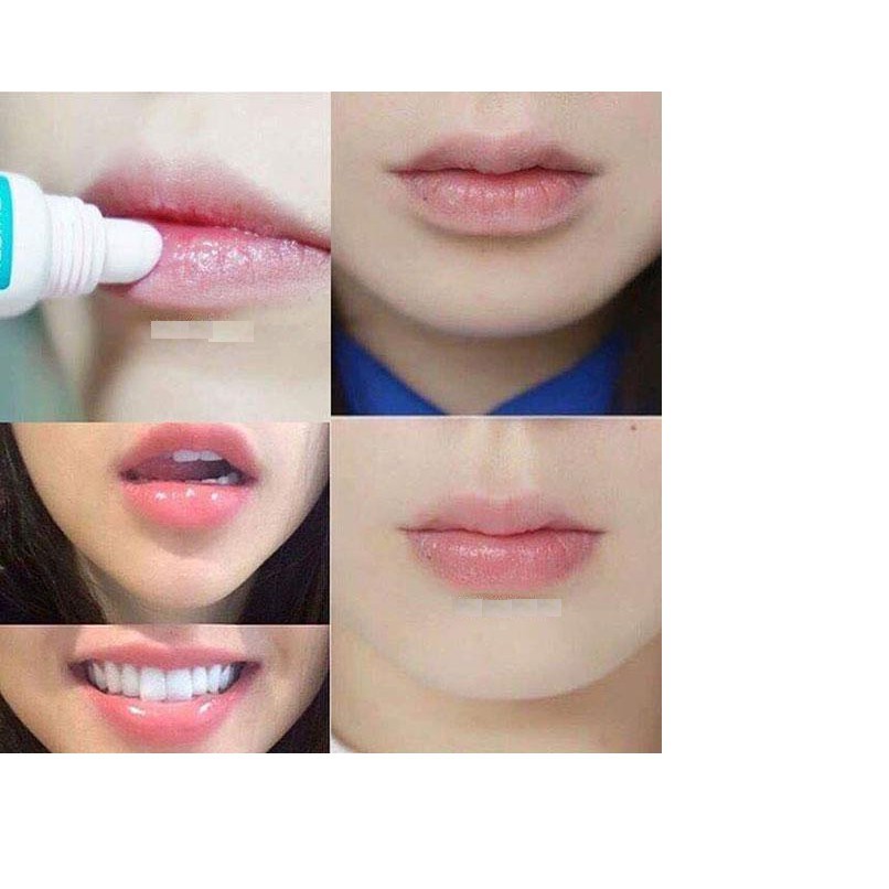 Son Dưỡng cho môi thâm, bợt màu, nhợt nhạt Mediheal Labocare Panteno Lips Healssence 10ml (Dùng Ban Ngày)