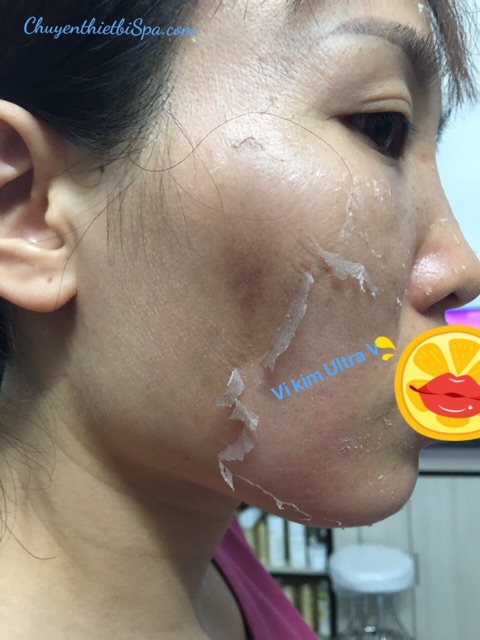 Vi kim tảo biển Ultra V Premium Peeling - 01 cặp chính hãng Hàn Quốc | BigBuy360 - bigbuy360.vn