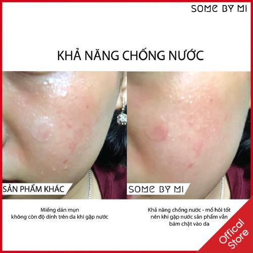Miếng dán mụn Some By Mi Acnes Clear Patch gói 18 miếng | BigBuy360 - bigbuy360.vn