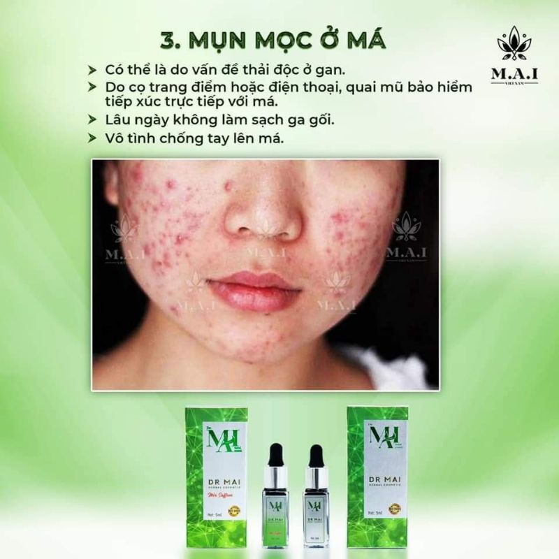 ✅Dr.Mai Tri Mun - Cam kết chính hãng 100%