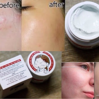 Kem ngừa mụn CIRACLE Red Spot Cream
