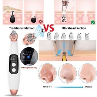 Máy Hút Mụn Đầu Đen Chăm Sóc Da Mặt 3 Đầu Hút Có Thể Điều Chỉnh
