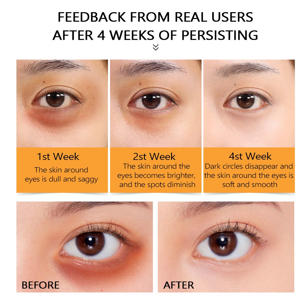 Serum Mắt Vitamin C Vibrant Glamour Chống Lão Hóa/ Nếp Nhăn Mờ Quầng Thâm Giảm Bọng Mắt Dưỡng Ẩm Và Làm Sáng Da 20ml | BigBuy360 - bigbuy360.vn