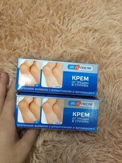 KEM TRỊ NỨT GÓT CHÂN NGA