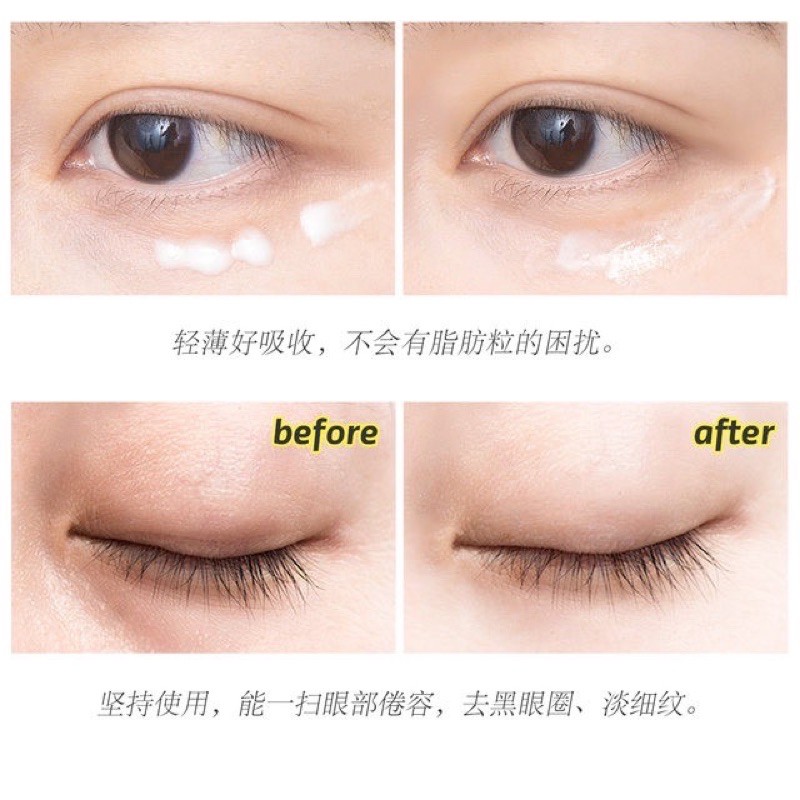 Kem Dưỡng Mắt Meishoku Placenta Medicated Whitening Eye Cream