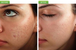 Kem Laysmon Beauty Cream