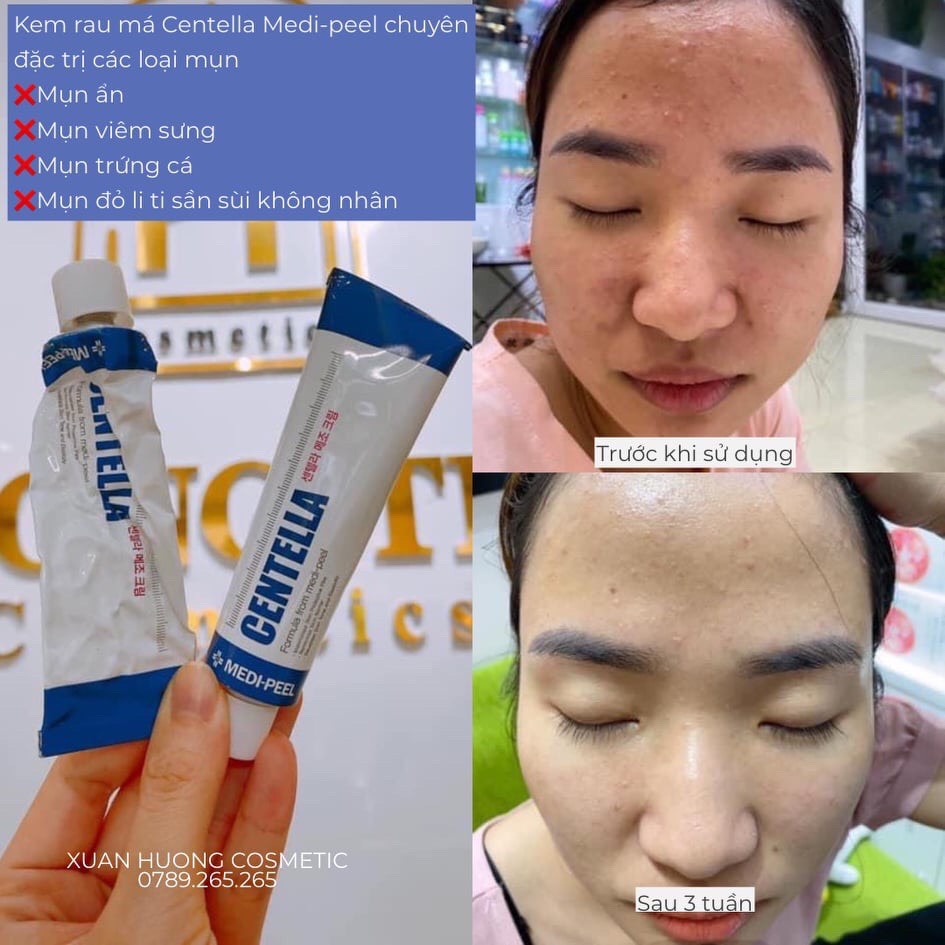 Kem Mụn MediPeel Centella Mezzo Cream, Cải Thiện Phục Hồi Da - 30ml [ Auth - Hàn Quốc ]
