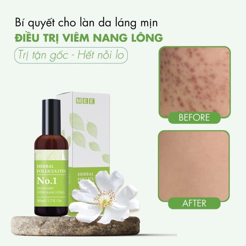 [HÀNG CHÍNH HÃNG]Thảo Mộc Viêm Nang Lông NEEM - Mee Natural