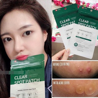 [ Chính Hãng ]Miếng dán mụn Some By Mi Clear Spot Patch