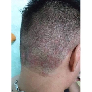 Dầu cám gạo v da cơ địa