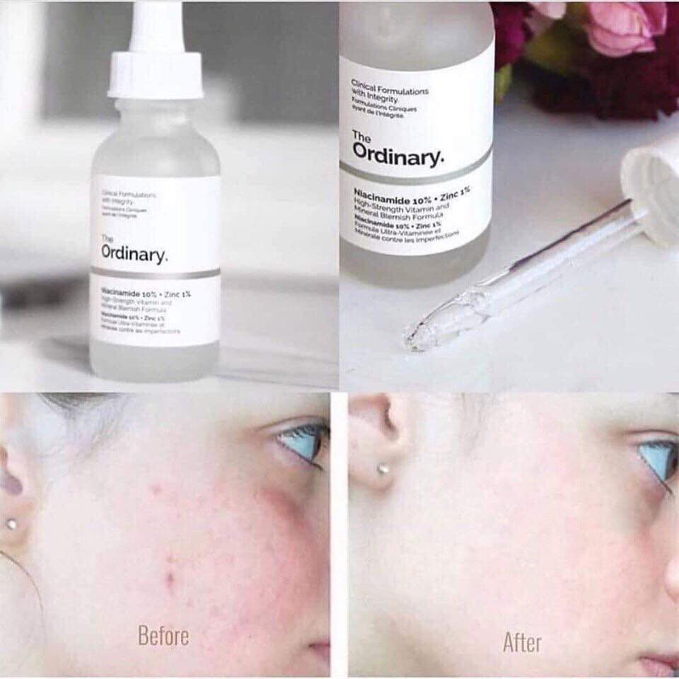 Tinh Chất Mờ Thâm Mụn & Làm Sáng Da Niacinamide 10% + Zinc 1% The Ordinary