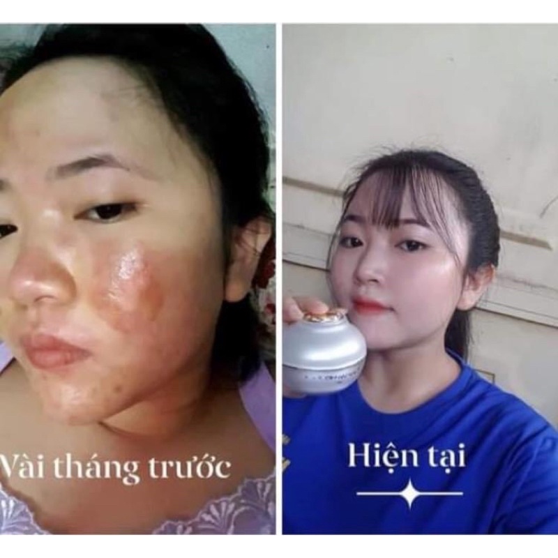 Kem Vip Dưỡng Trắng,Chống Nắng,Ngừa Mụn Nám,Chống Lão Hoá(Hộp 30gr)