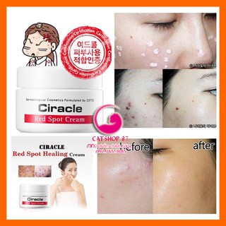 KEM GIẢM MỤN CIRACLE RED SPOT CREAM