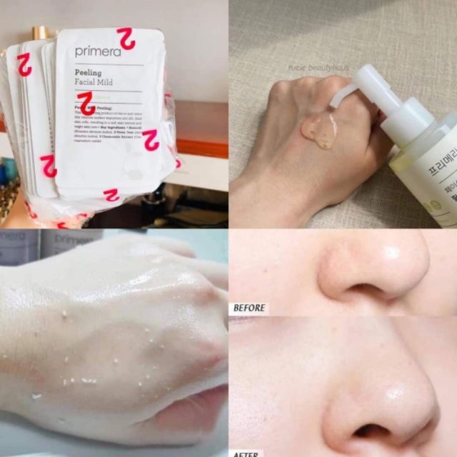 Gel tẩy da chết Primera Facial Mild Peeling - 10 gói date 2023