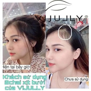 XỊT BƯỞI VIJULLY KÍCH MỌC TÓC SIÊU DÀI