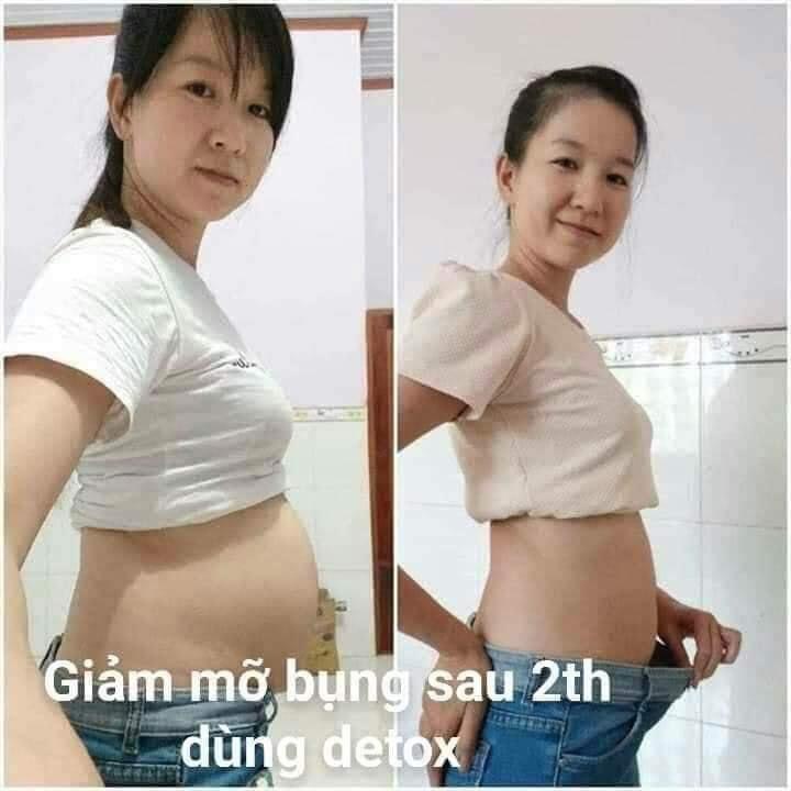 Detcx night giảm mỡ bụng chuyên sâu