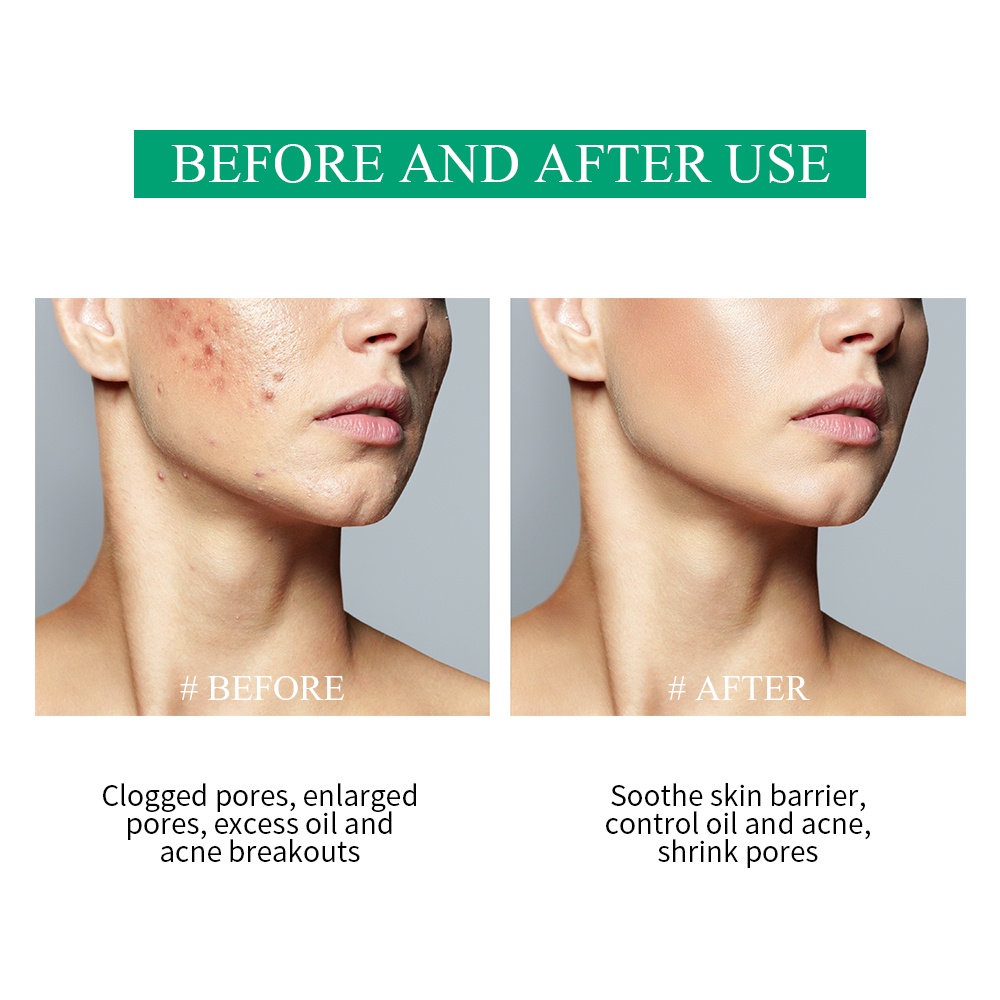 Mặt Nạ Đất Sét BREYLEE Chiết Xuất Từ Cây Trà/Lô Hội/Hoa Đào/Hoa Anh Đào Dưỡng Ẩm Kiểm Soát Dầu Làm Dịu Da 0.28oz/8g