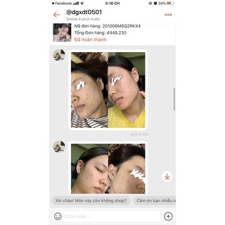 Serum biểu bì Vaurora