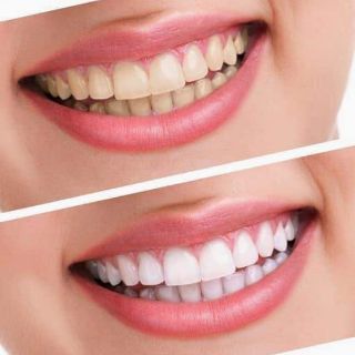 KEM ĐÁNH RĂNG NHÂN SÂM THẢO DƯỢC CAO CẤP RYO