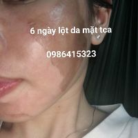 PEEL THAY DA MẶT TCA DÀNH CHO NAM