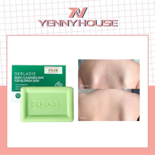Soap Xà Bông Giảm Mụn Body Ngực Cơ Thể Sau 7 Ngày Derladie Body Cleansing Bar For Blemish Skin