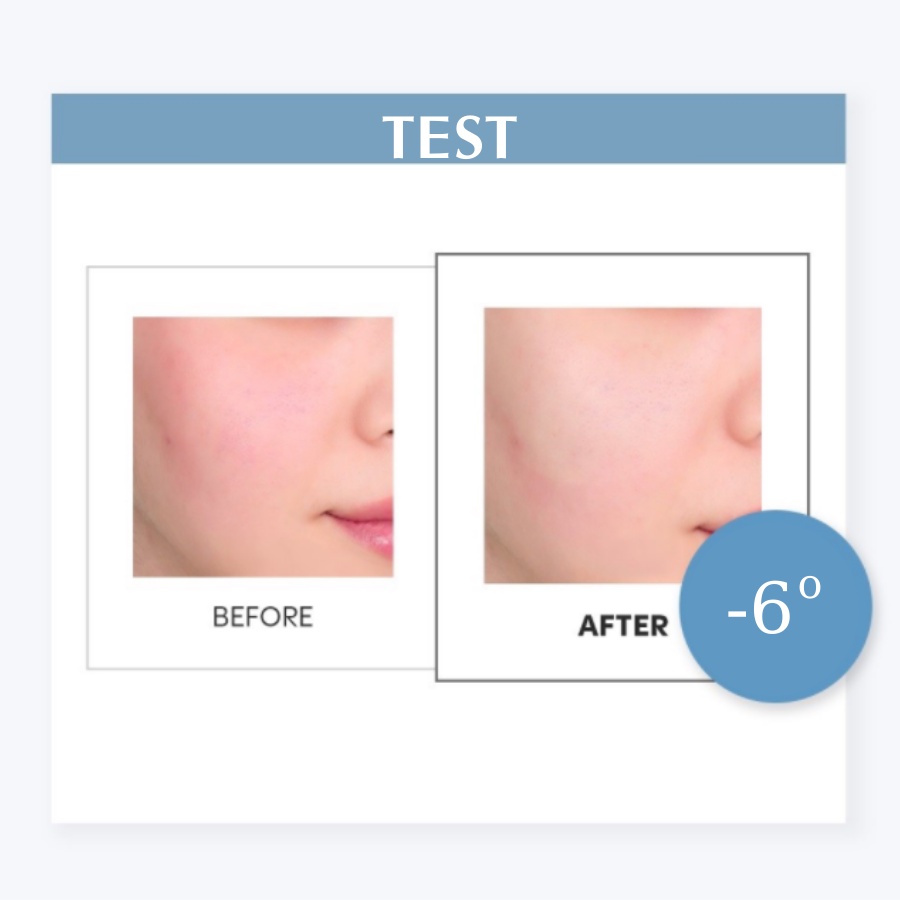 Combo 4 set miếng dán chống nắng chơi thể thao dành cho mặt AHC Masters Pro Patch 8g + Sun Cream SPF50+ PA++++ 1.5ml