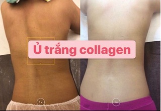 Ủ trắng da body cá hồi