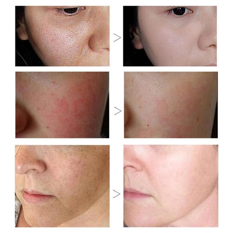 Kem Mát Xa Làm Trắng Vùng Da Dưới Cánh Tay / Đầu Gối / Chân 70g