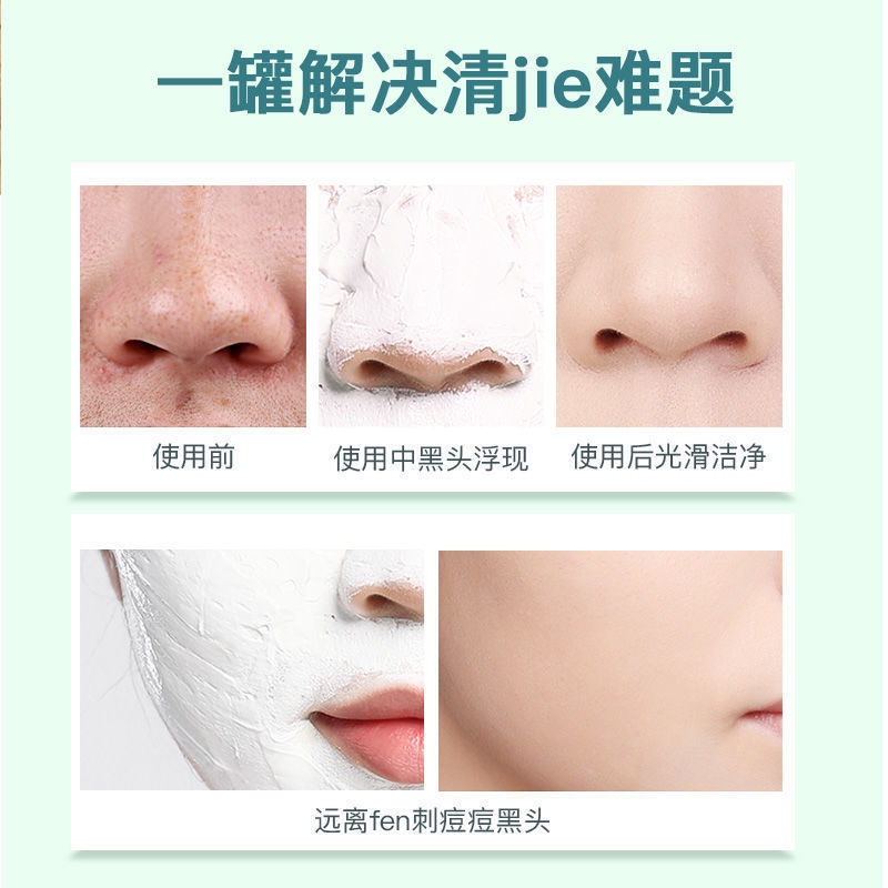 Mặt Nạ Bùn Làm Trắng Dưỡng Ẩm Loại Bỏ Mụn Đầu Đen