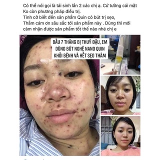 Bút nghệ nano Quin